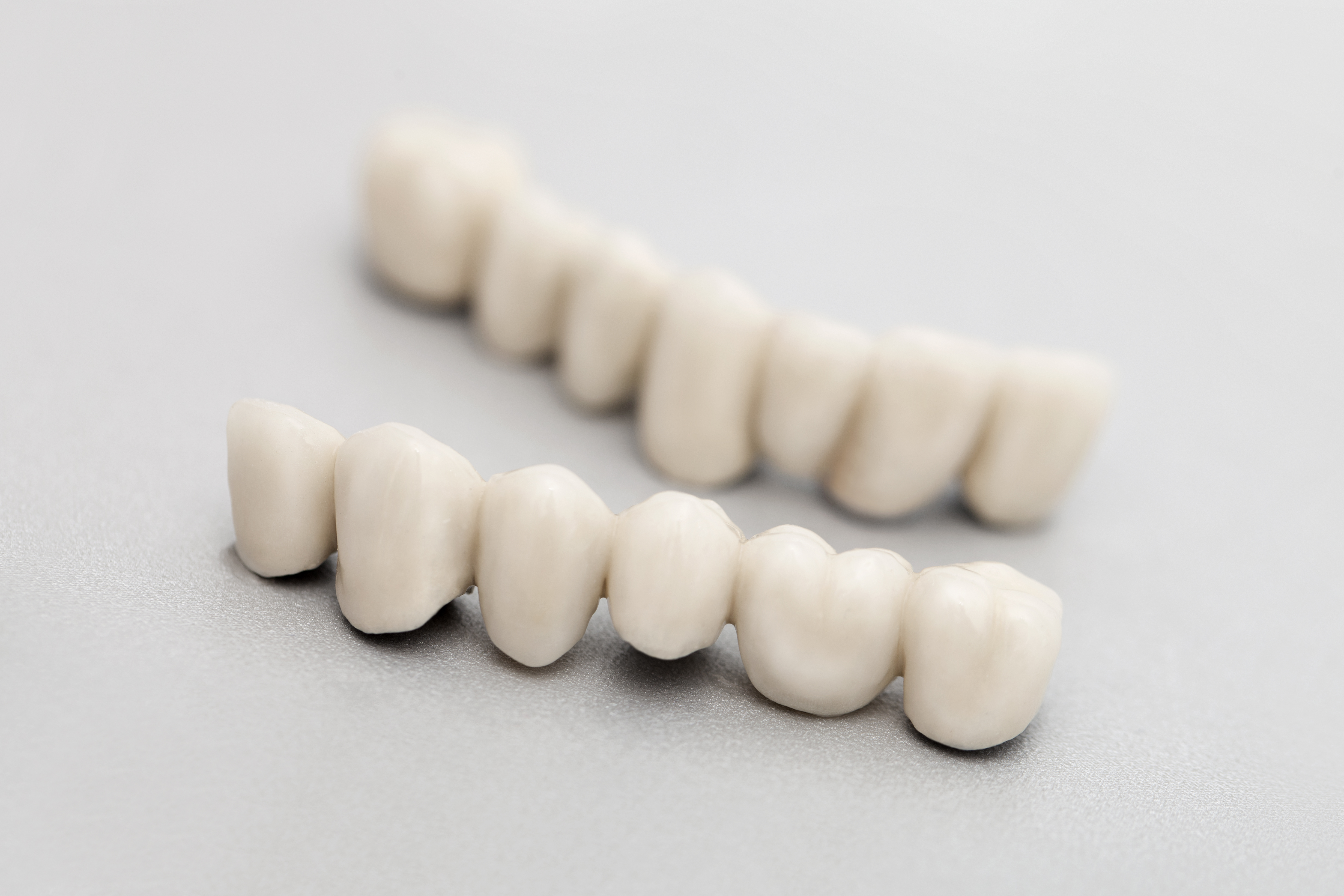 Porcelain Crowns