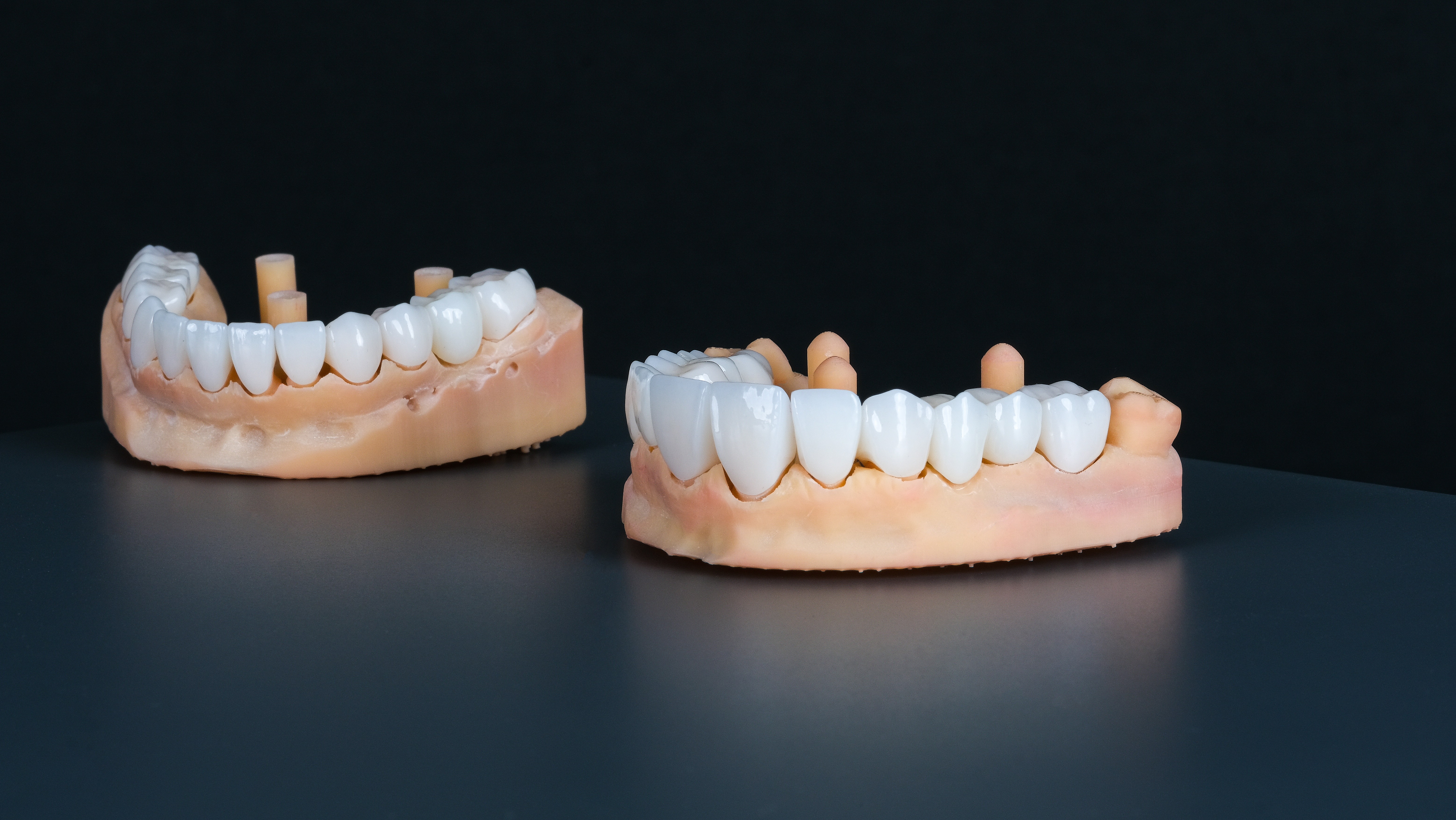 Zirconium Crowns