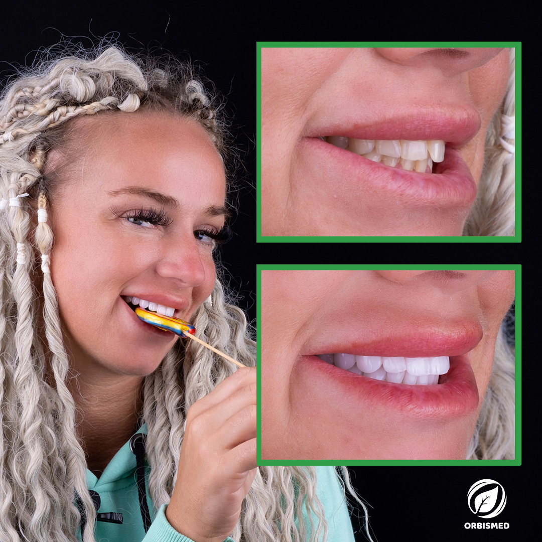 Patient 91 - Before & After