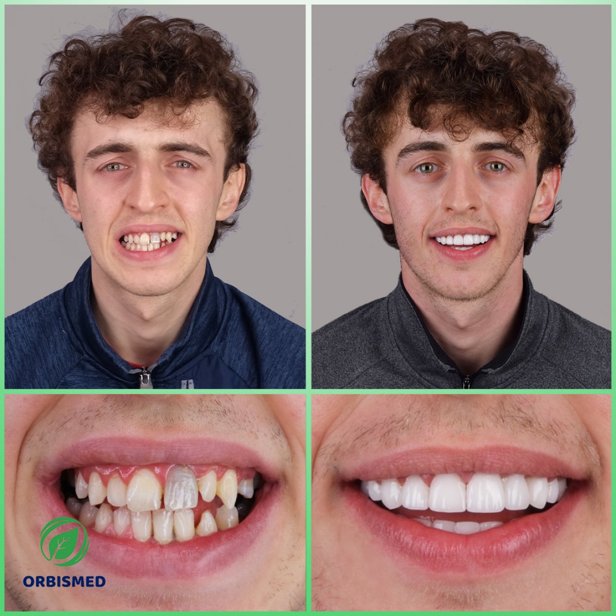 Patient 89 - Before & After