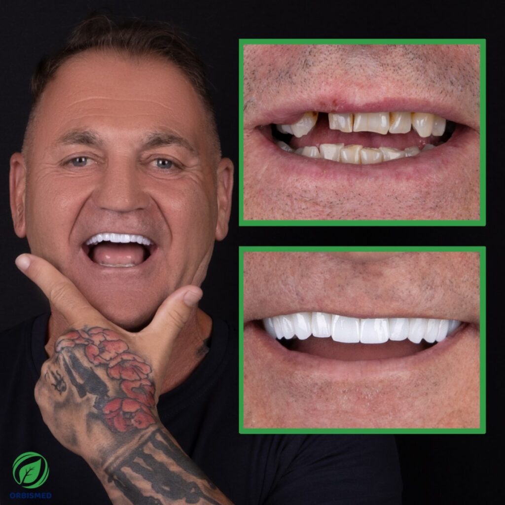 Patient 83 - Before & After