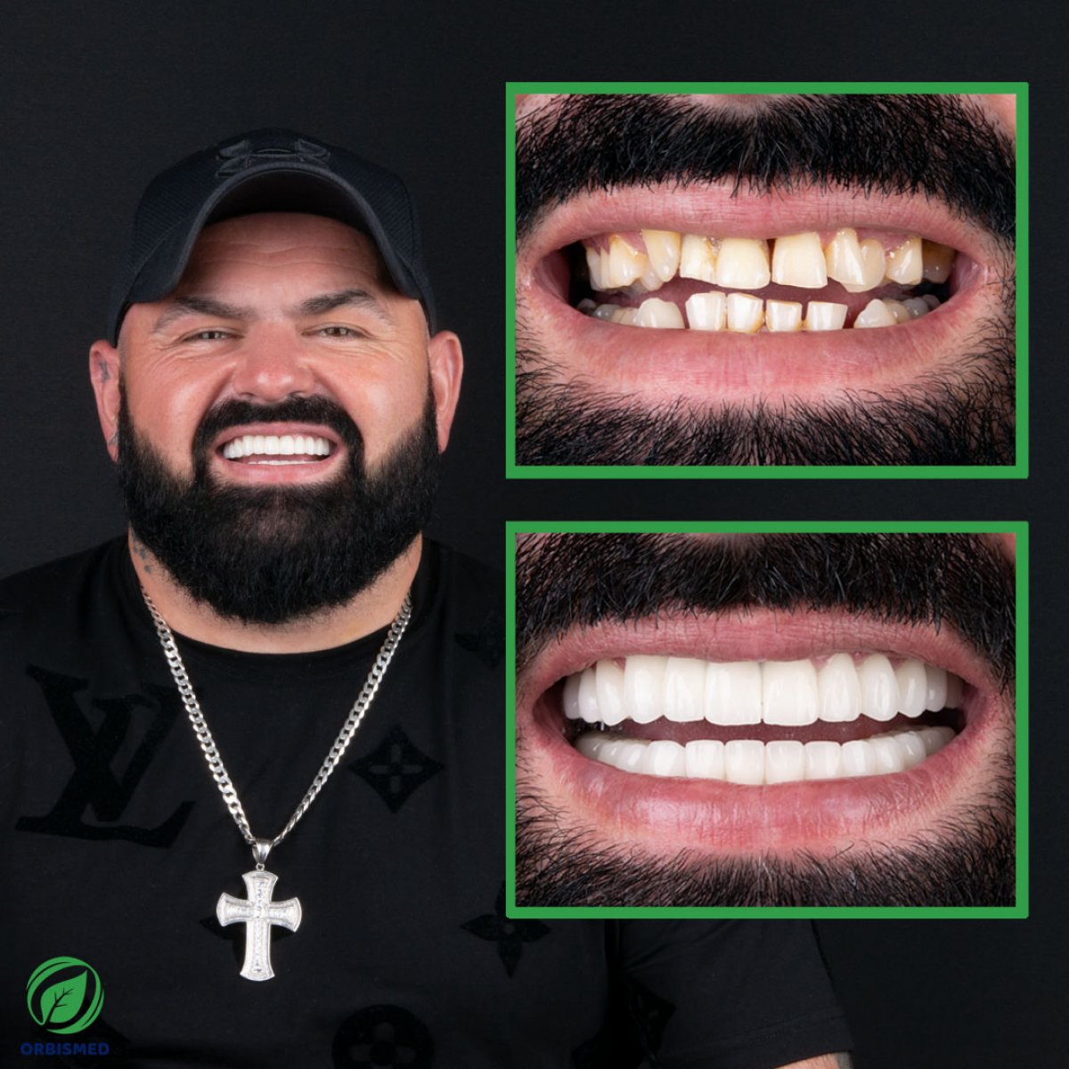 Patient 81 - Before & After