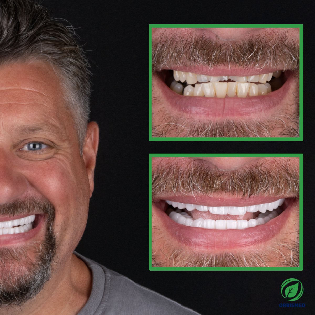 Patient 72 - Before & After