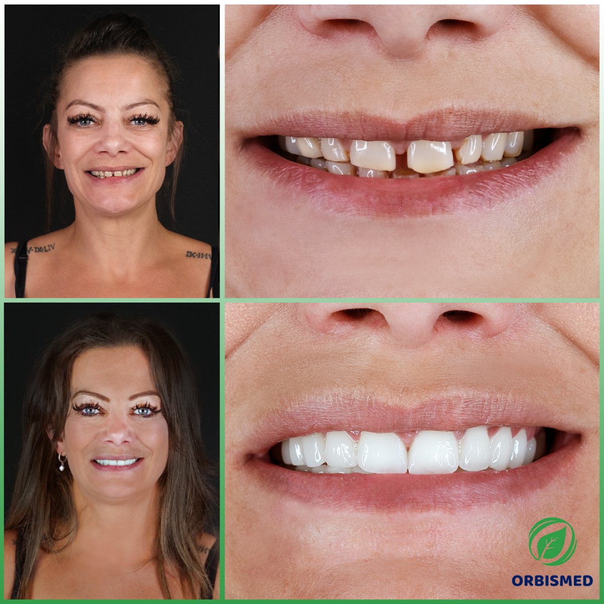 Patient 9 - Before & After