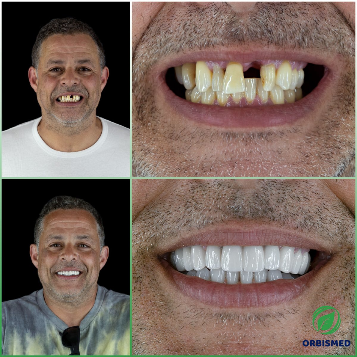 Patient 77 - Before & After
