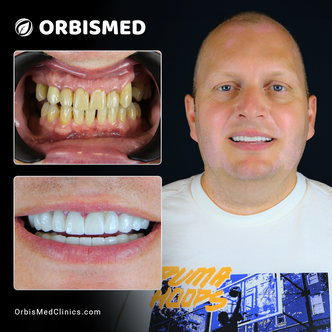 Patient 59 - Before & After