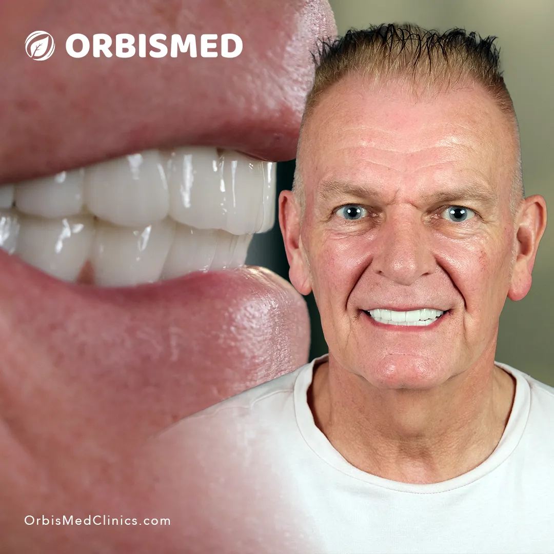 Patient 60 - Before & After