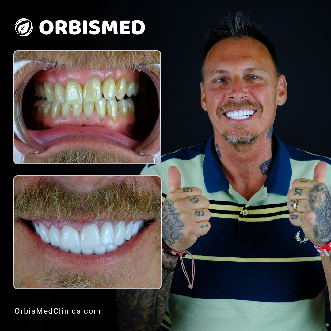 Patient 53 - Before & After