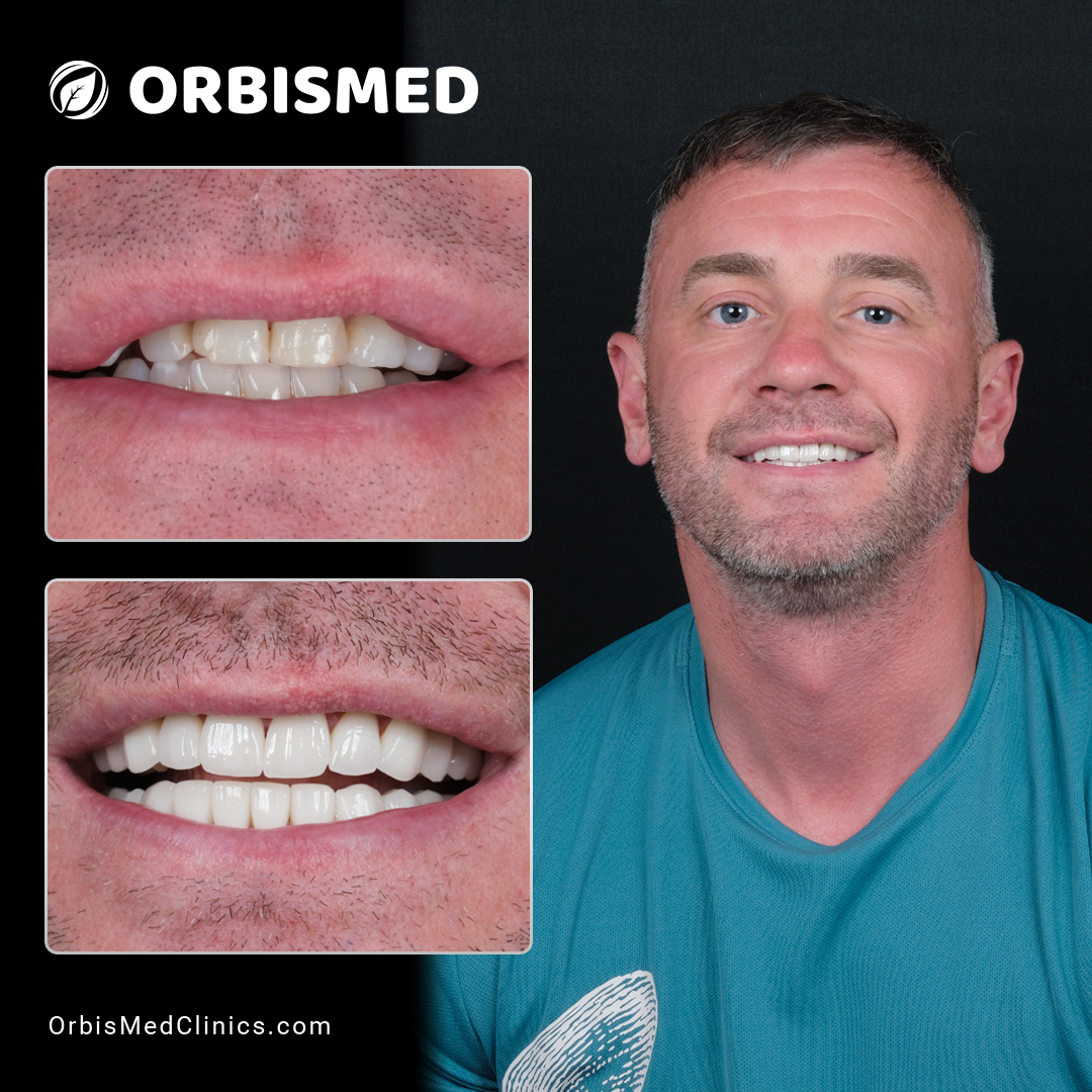 Patient 55 - Before & After
