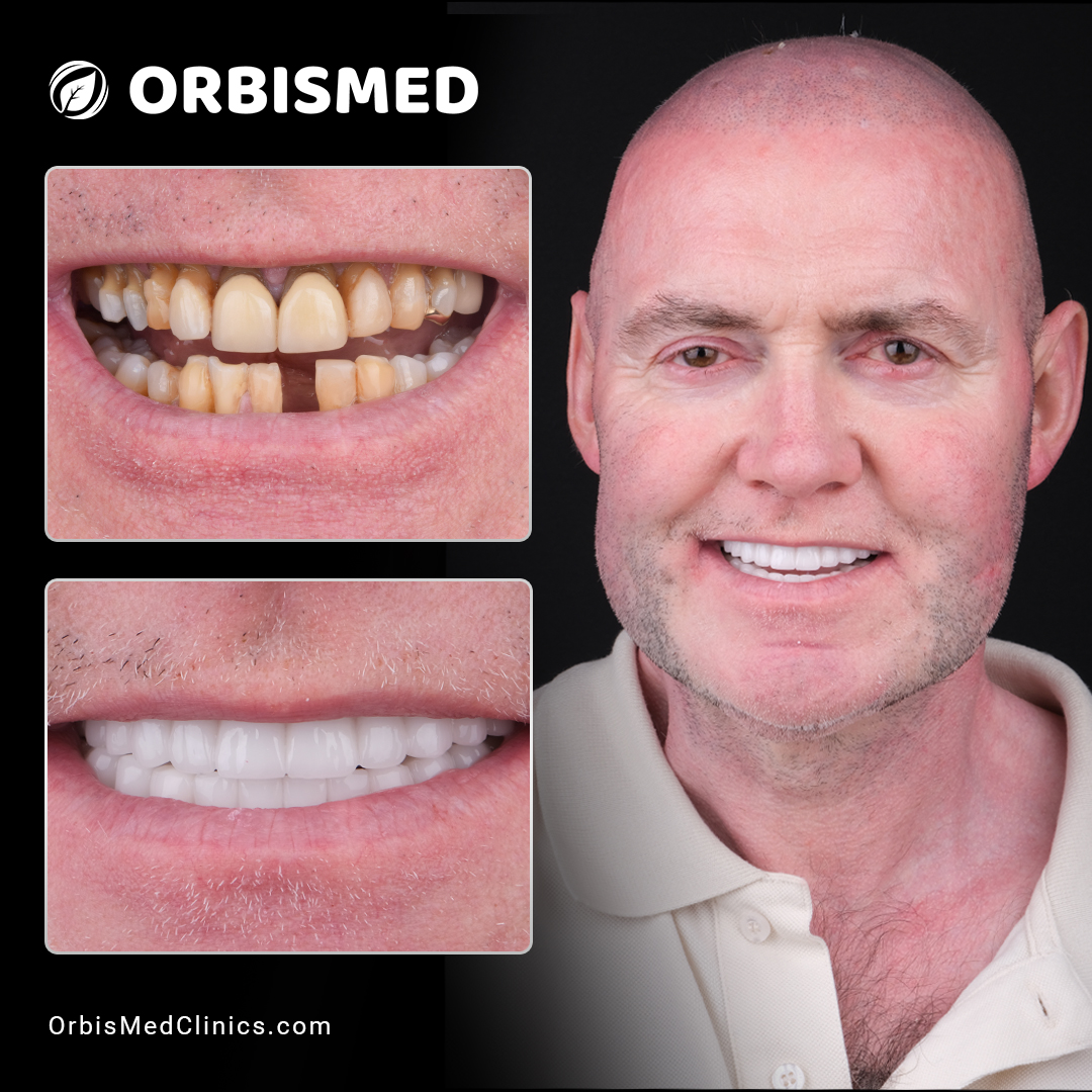 Patient 50 - Before & After