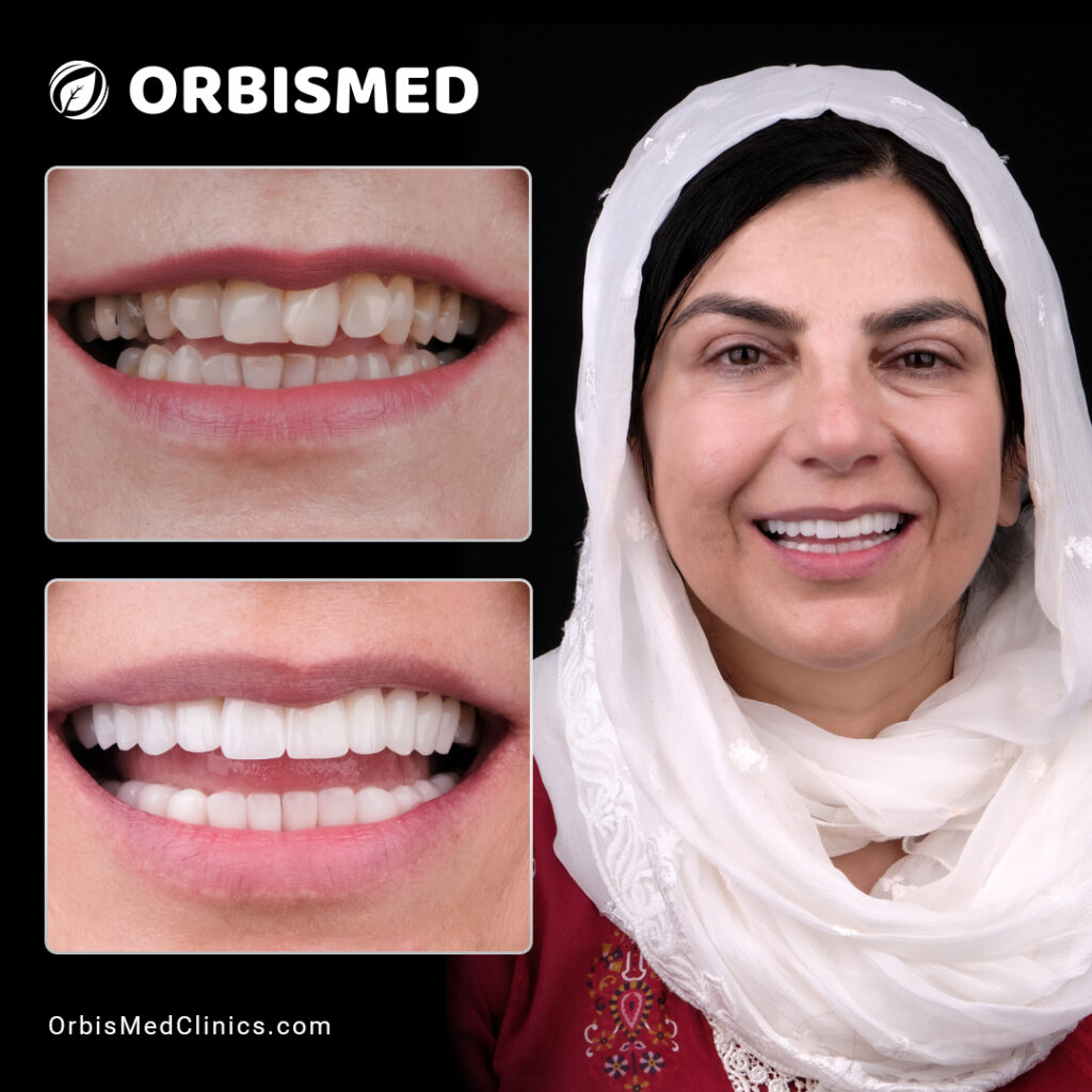 Patient 42 - Before & After