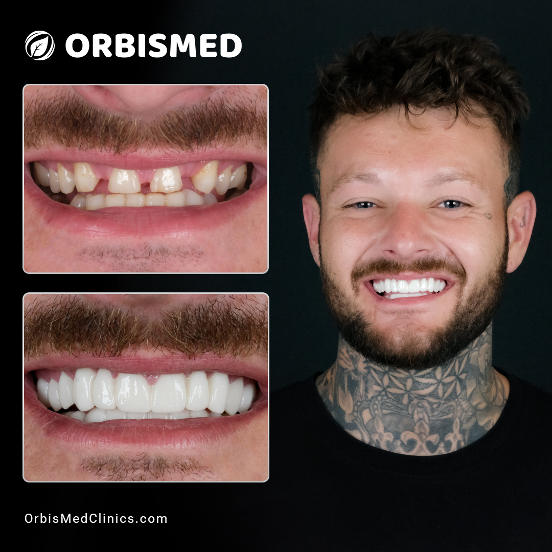 Patient 37 - Before & After