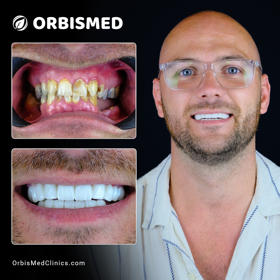 Patient 5 - Before & After