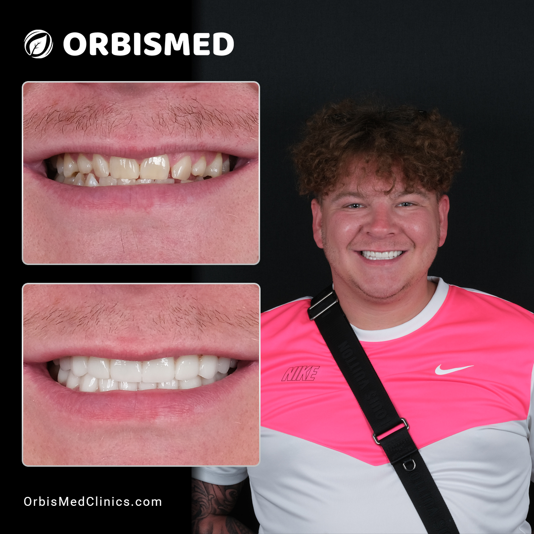 Patient 26 - Before & After