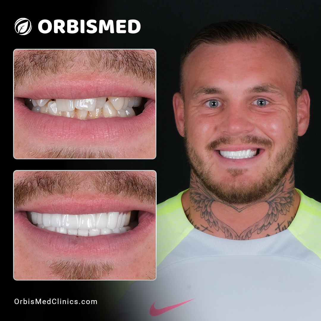 Patient 27 - Before & After