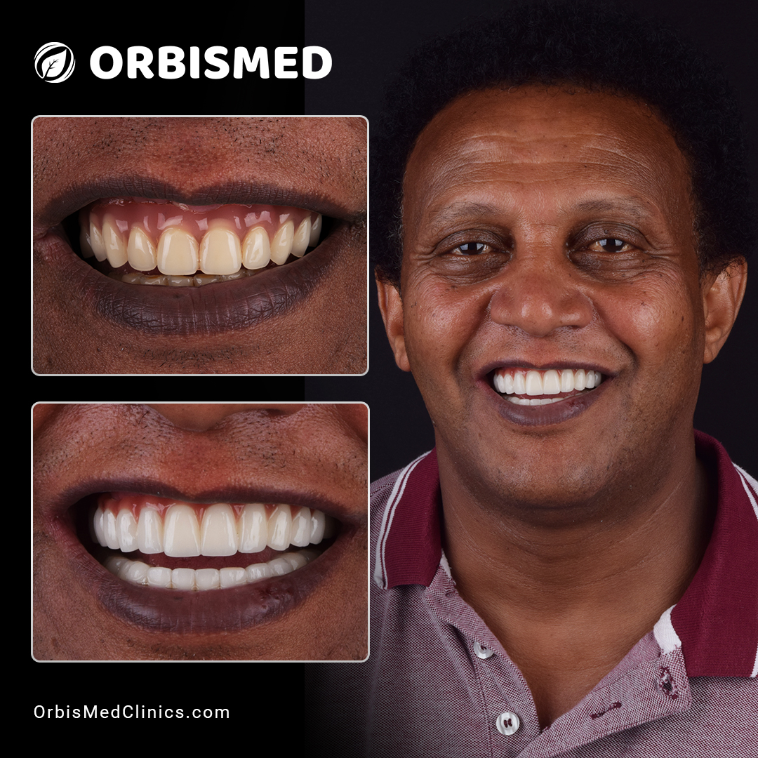 Patient 28 - Before & After