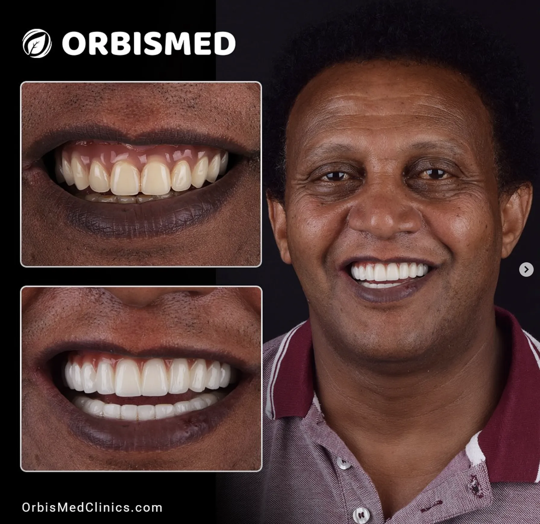 Patient 29 - Before & After
