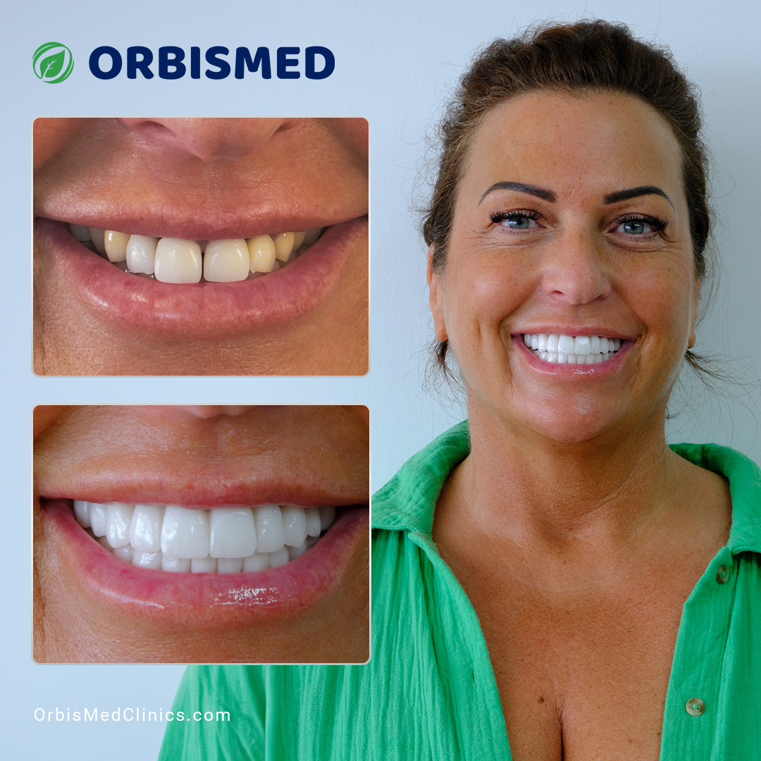 Patient 30 - Before & After