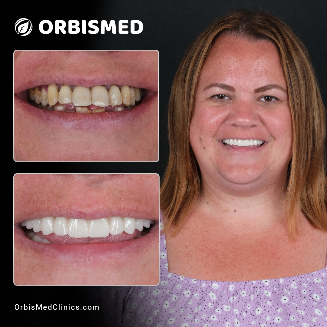Patient 31 - Before & After