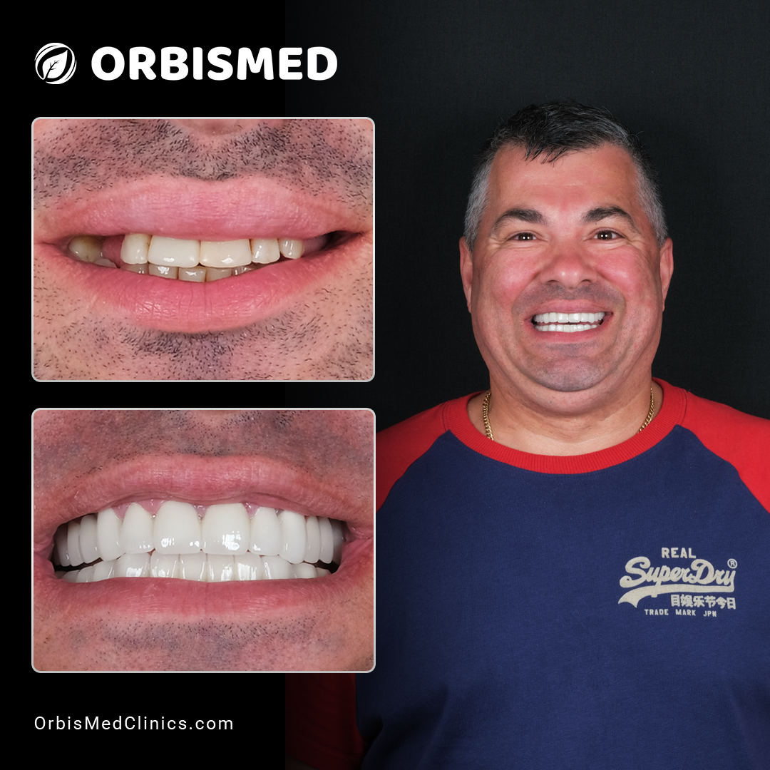 Patient 24 - Before & After