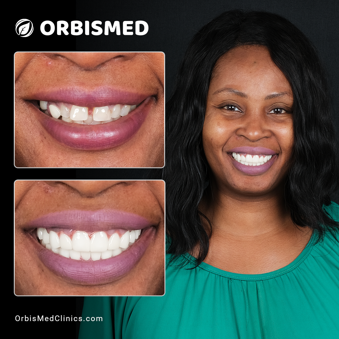 Patient 25 - Before & After