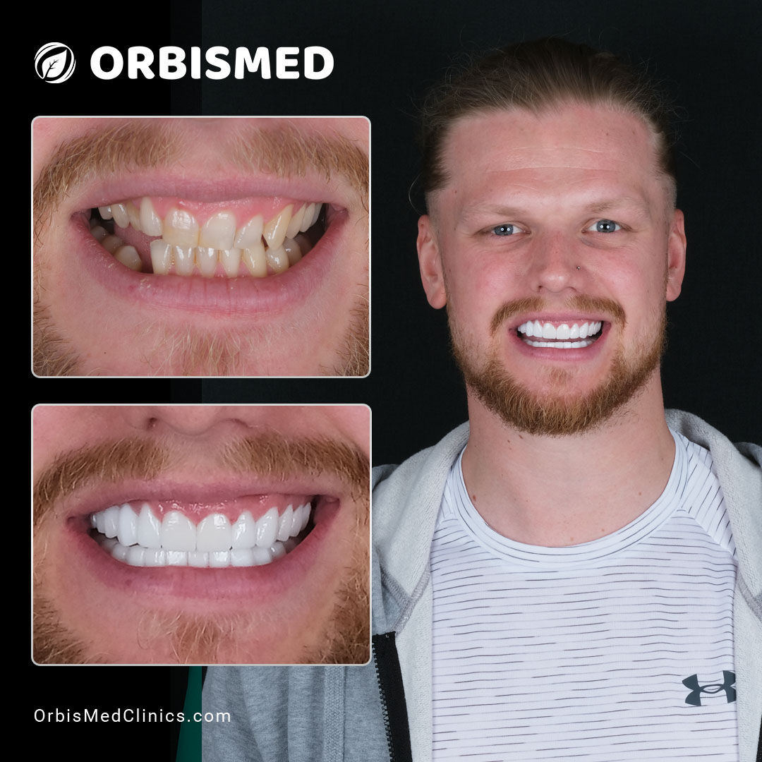 Patient 15 - Before & After