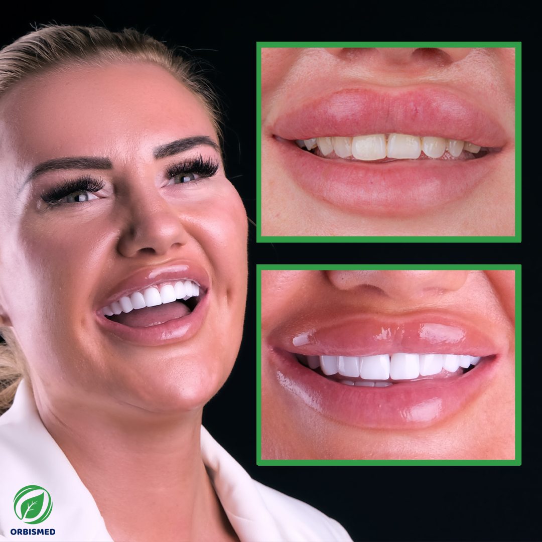Patient 3 - Before & After