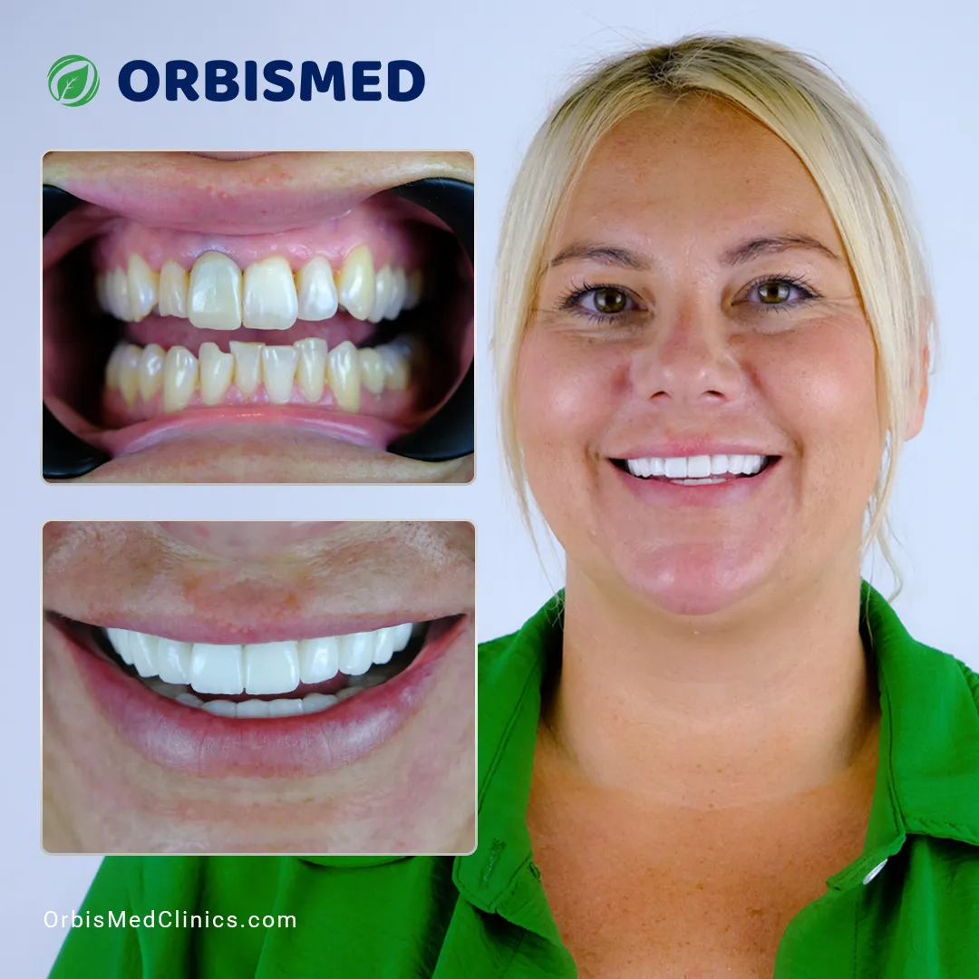 Patient 7 - Before & After