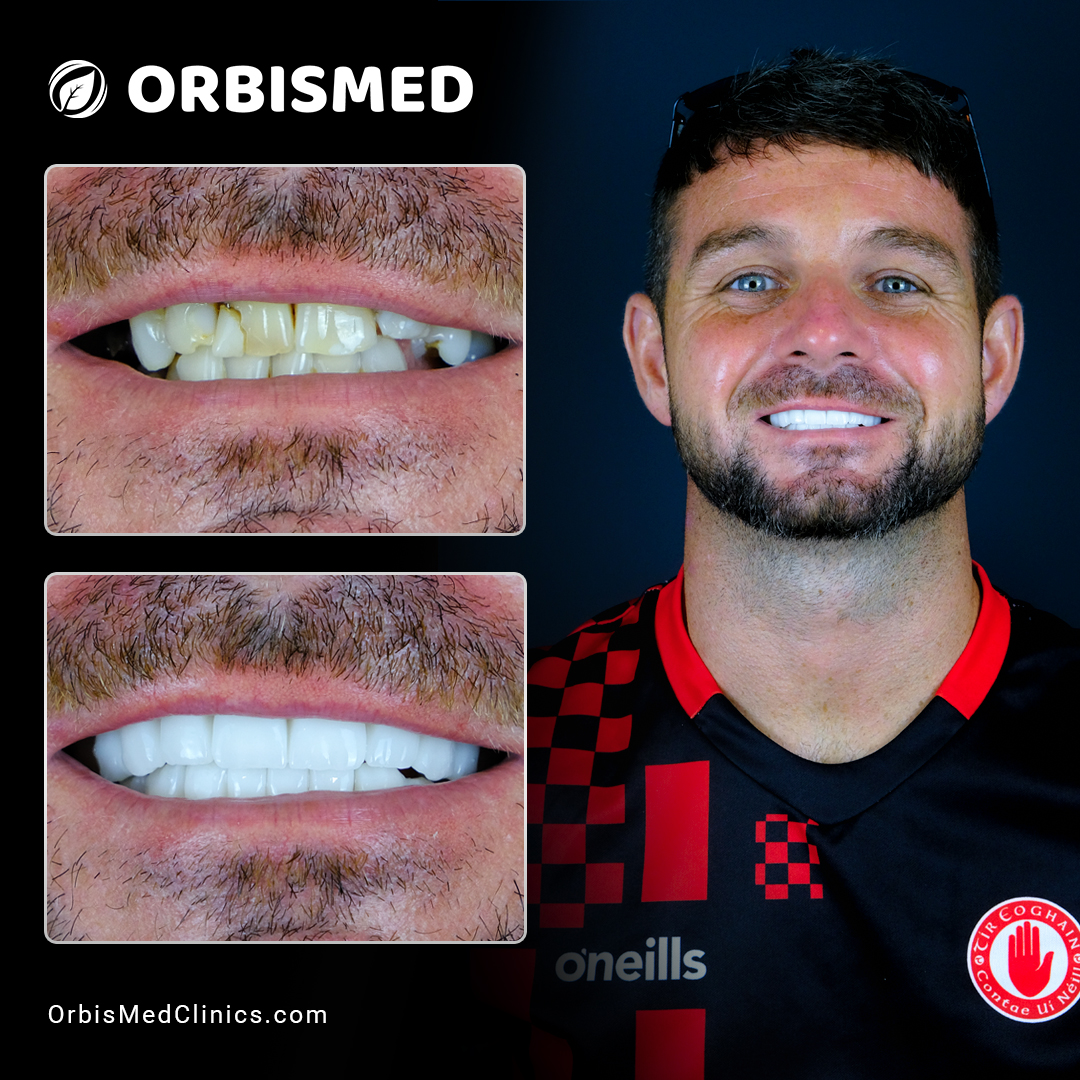 Patient 6 - Before & After