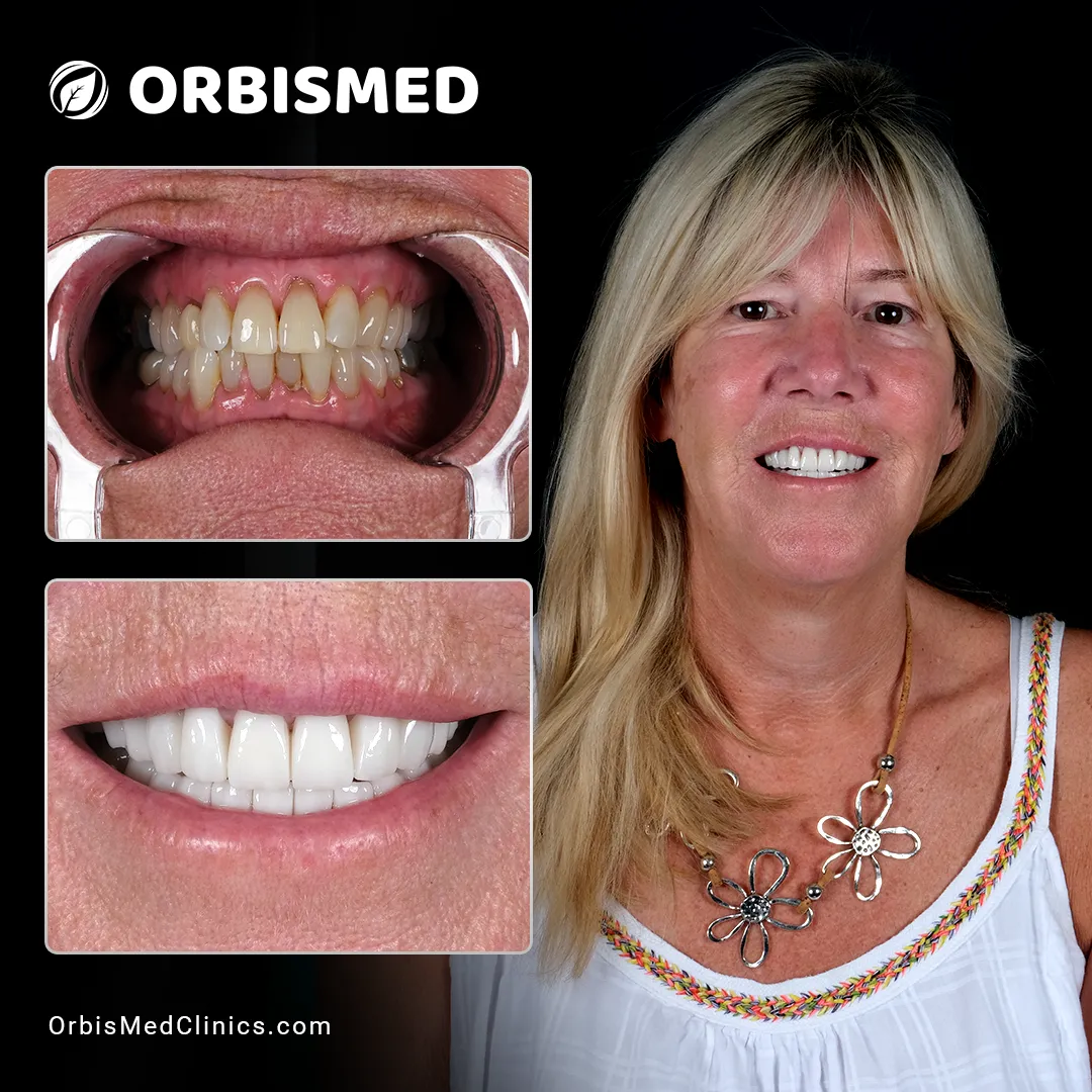Patient 12 - Before & After