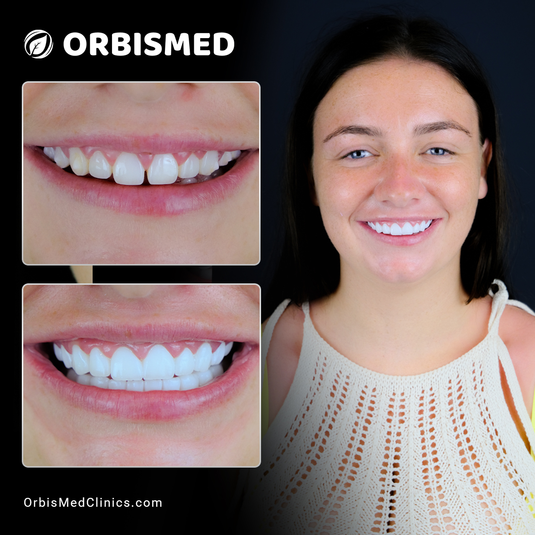 Patient 11 - Before & After