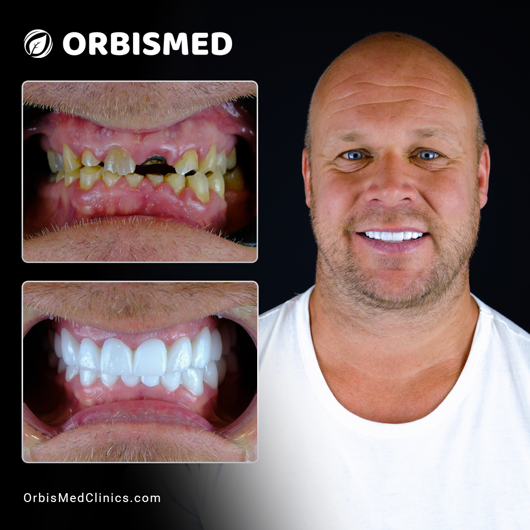 Patient 8 - Before & After