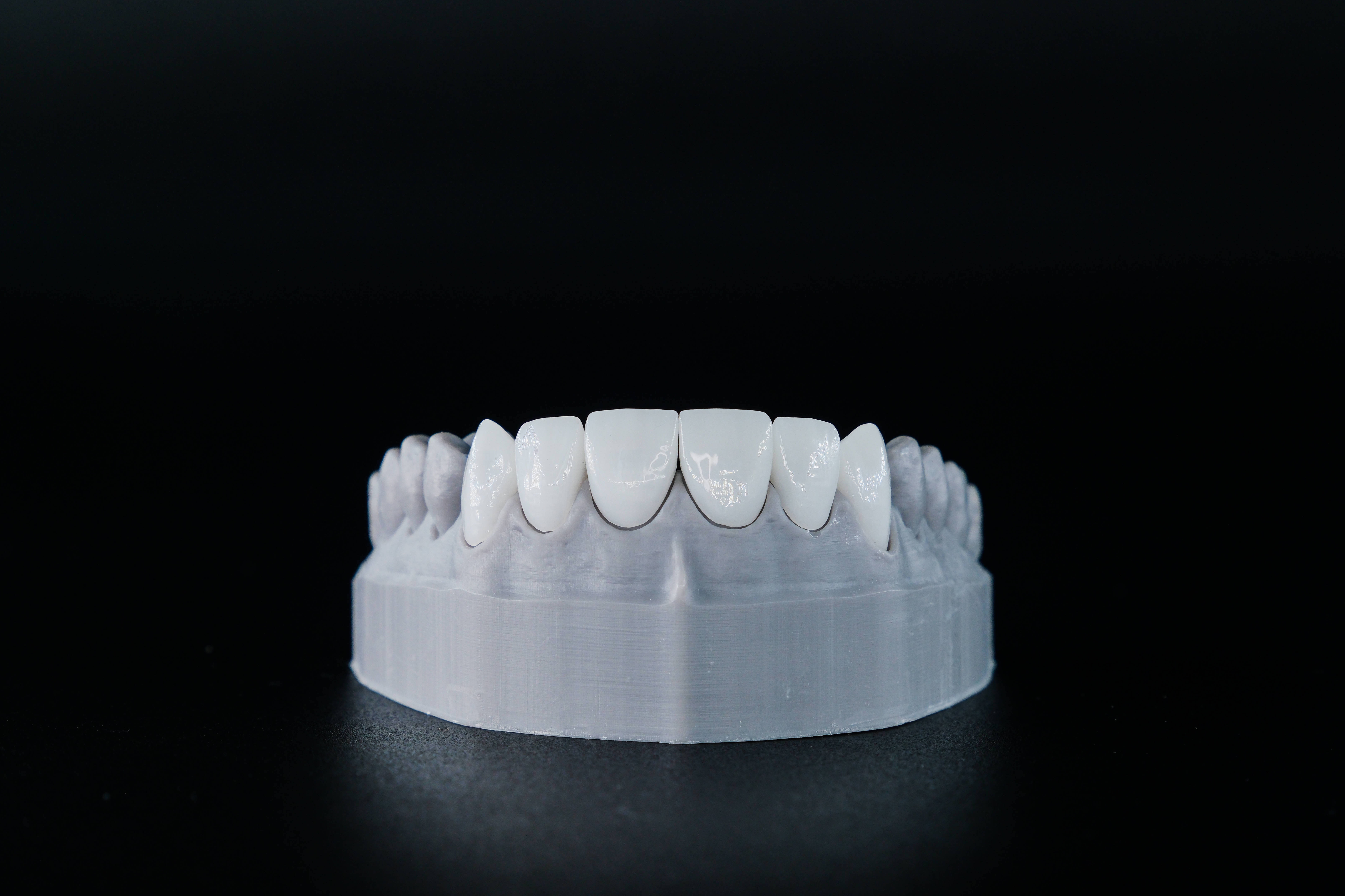 Porcelain Veneers in Turkey